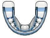 013 2149 z 52,00 MYOBRACE Isasan Dispositivo miofunzionale progettato per ottenere l allineamento dei