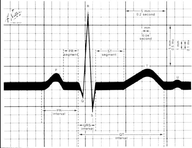 Le onde e i segmenti elettrocardiografici R 15 ST Contrazione Atriale P T U PR o PQ