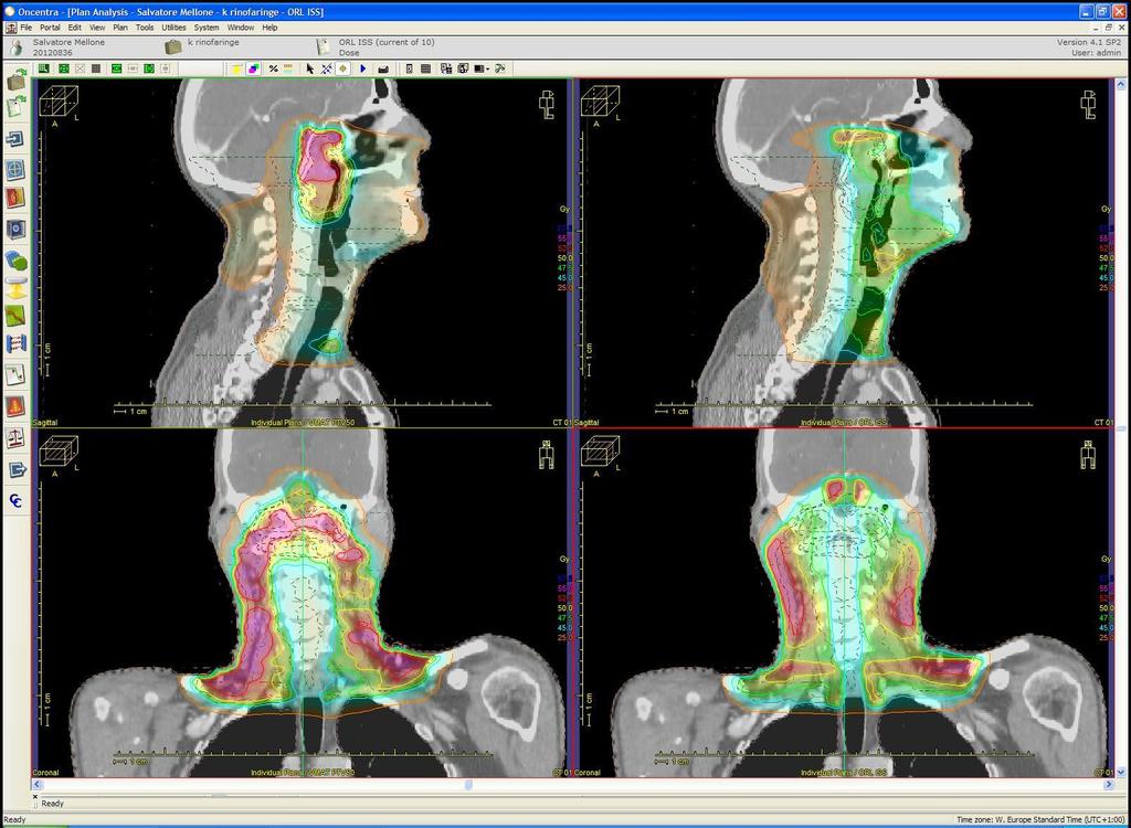 VMAT vs 3D-CRT Esempio di