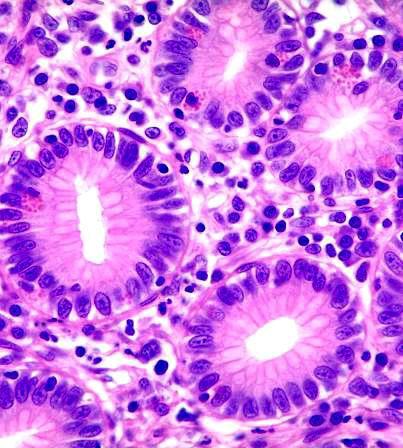 TESSUTO CONNETTIVO propriamente detto: il CONNETTIVO LASSO Poche fibre Abbondante la ECM amorfa (PG e GP) Sono presenti molte cellule, per lo più