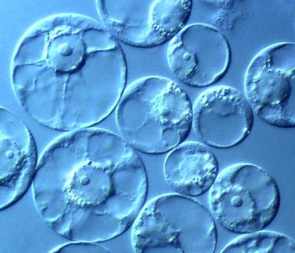 Membrana plasmatica La membrana plasmatica delle cellule vegetali è esposta soltanto quando viene rimossa la parete cellulare (protoplasti)