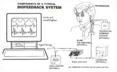 3) FASE TARDIVA OBIETTIVO DELLO STUDIO Effettuare uno studio di Outcome Research su un campione di individui affetti da Retinite Pigmentosa per valutare l efficacia del trattamento