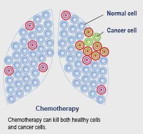 La chemioterapia è un trattamento sistemico che si basa sul principio che le cellule tumorali si riproducono più rapidamente di quelle normali.