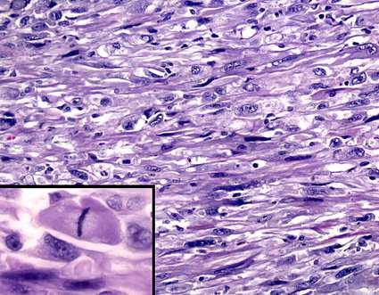 Terapia e follow-up dei carcinomi differenziati Dopo l intervento ditiroidectomia, vengono iniettate grandi dosi di iodio radioattivo 131 ( 131 I).