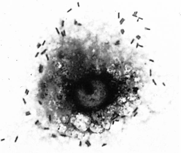 FAGOCITOSI MACROFAGICA Macrofago alveolare umano in attiva fagocitosi batterica.