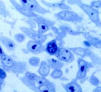 Plasmacellula Semifine blu di