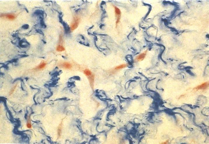 Tessuto connettivo mucoso Fibroblasti e matrice extracellulare nel cordone