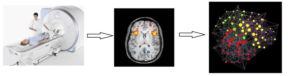 FUNCTIONAL NEURAL NETWORK Spigoli: connessioni funzionali tra due nodi, che tendono quindi a partecipare congiuntamente