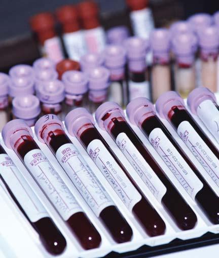 Sorveglianza donatori di sangue 2008 L indagine 2008 è stata complessa a causa dell introduzione di nuovi sistemi diagnostici.