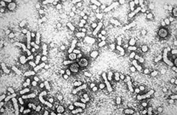 VIRUS EPATITE B (HBV) Tassonomia e Struttura Famiglia Hepadnaviridae, genere Orthohepadnavirus Forma sferica (d: 27-32 nm)