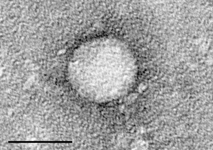 VIRUS EPATITE C (HCV) Tassonomia e Struttura Famiglia