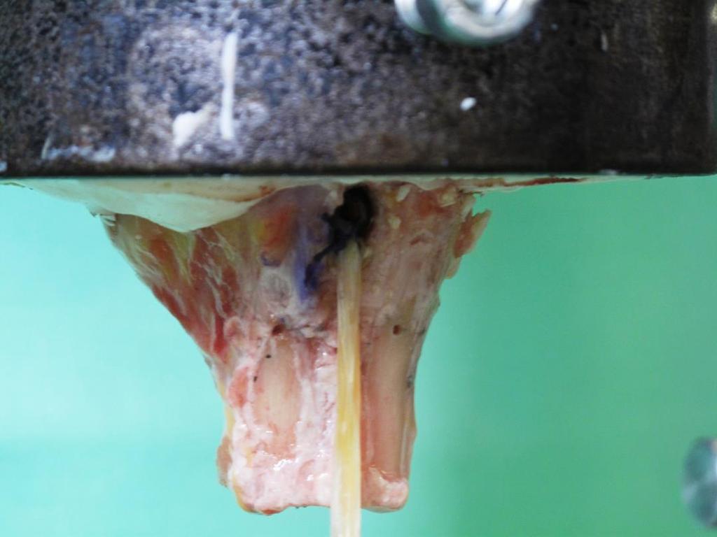 Figura 18: omero con tecniche di tenodesi con vite ad interferenza montato sulla instron prima dell inizio dei test di carico Completata la tecnica chirurgica, l omero è stato montato sulla parte
