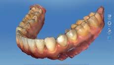 18 Full arch scanning: l ortodonzia diventa digitale con CEREC Corso di abilitazione Dr. Dario Maccari 8 mezza giornata Dr.