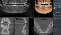 26 Corso di abilitazione Il corretto utilizzo della tecnologia 3D Cone Beam Specialist Dentsply Sirona Academy SESSIONE TEORICA > Posizionamento del paziente e individuazione dei più comuni errori >