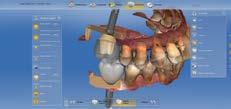 29 Corso specialistico Pianificazione del trattamento implantare, progettazione protesica con metodica CEREC chairside in Live Surgery Prof. Alfonso Baruffaldi Dr.