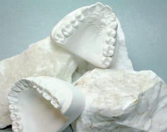 Gesso per articolatori, Tipo 2 Universal Gesso dentale con alabastro Prodotto con alabastro puro delle montagne dell Harz, con l aggiunta di 25% di gesso duro.