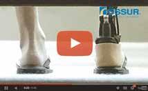 Un ginocchio protesico garantisce un movimento fluido e naturale unitamente ad un giusto livello di stabilità, il modulo piede, invece, offre un ritorno