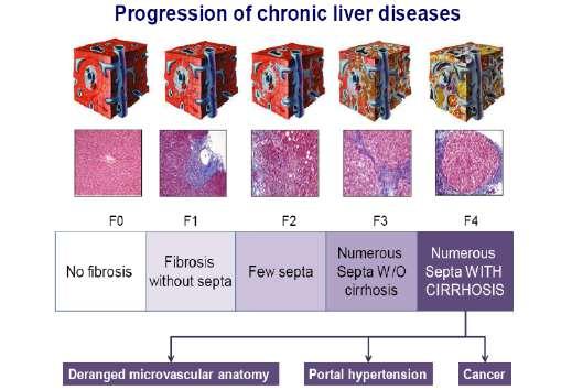 and HCV + status