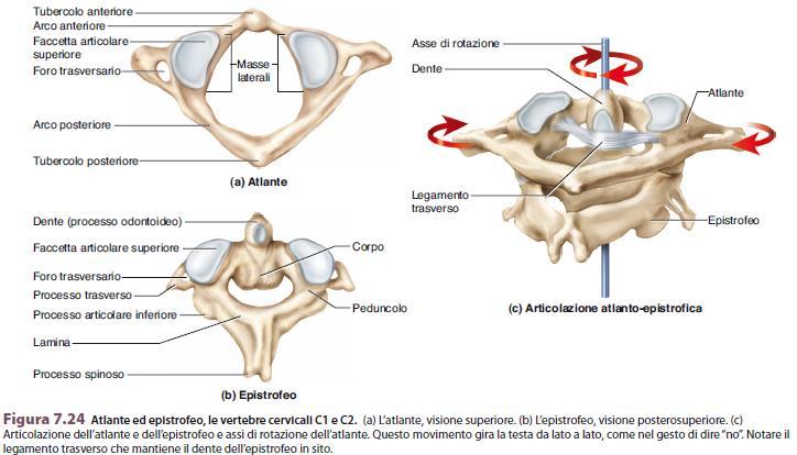 articolazioni atlo-epistrofiche (3) : mediana o atlo-odontoidea (1) e laterali (2) Le 3 articolazioni vengono coinvolte