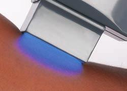 Excilite-µ TARGETED PHOTOTHERAPY CON EXCILITE-µ: BENEFICI REALI NELLA CURA DELLA VITILIGINE E DELLA PSORIASI Vitiligine e psoriasi sono malattie abbastanza comuni: nel mondo colpiscono il 2-3% della