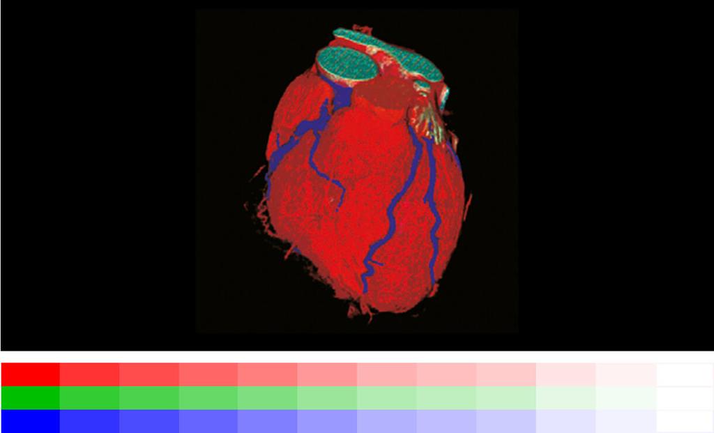 Eccellente qualità per la massima precisione nei dettagli L elevata risoluzione di 2 megapixel (a colori), l alto rapporto di contrasto a 1500:1 e la luminosità stabile fino a