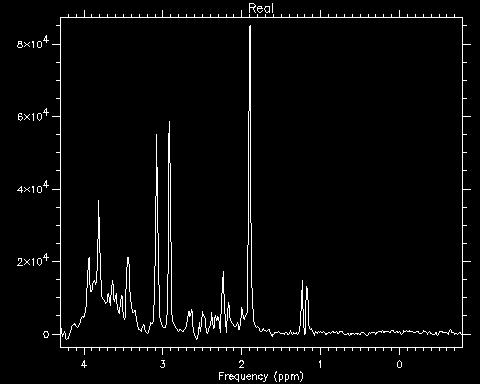 MR Spectroscopy TECNICA NON INVASIVA CHE VALUTA IL PROFILO METABOLICO (QUANTITATIVO E QUALITATIVO) DEL TESSUTO PRESO IN ESAME MEDIANTE PARTICOLARI SEQUENZE DI RISONANZA MAGNETICA METABOLITI PRESI IN