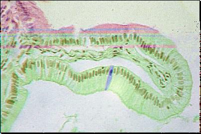 cellule perenni cellule stabili con perdita definitiva sospendono della capacità la loro attività