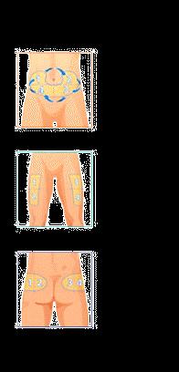 Oltre alla zona va cambiato ogni volta il lato di iniezione: una volta il braccio destro, una volta quello sinistro, una volta l