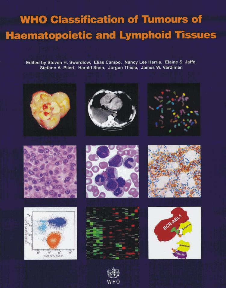 AML: Diagnosis and Classification 2008 1. Morphology & Immunophenotype 2.