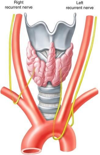 DIAGNOSI INTRAOPERATIVA DELLA LESIONE DEL RLN cause di lesione dei RLN: - sezione del nervo - l intrappolamento da legatura accidentale - la trazione durante la medializazzione del lobo tiroideo - le