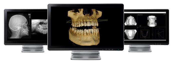 com Validity: NA CS 8100SC 3D Ecco il membro più recente della linea di successo CS 8100 Carestream Dental è lieta di presentare