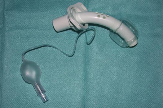 Cannula morbida con palloncino, senza camicia interna, tipo Montandon. Ruolo della tracheotomia percutanea nel bambino La tracheotomia percutanea è controindicata nel bambino.