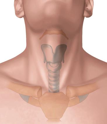 Tracheotomia I 46-430 1 2 3 Figura 3. Esposizione dell istmo tiroideo. 1. Tessuto adiposo sovraistmico; 2. istmo tiroideo; 3. tessuto adiposo sottoistmico e vene tiroidee inferiori. Figura 1.