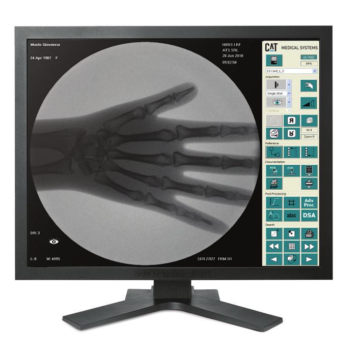 Reference images The operator can the image on the main monitor to the reference monitor and so create a reference image for the current study.for this option, a second monitor is necessary.