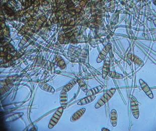 Pruni) FUNGHI O CRITTOGAME Organismi pluricellulari che hanno bisogno delle sostanze prodotte dalle piante per nutrirsi, hanno corpo micro o