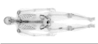 fotomoltiplicatori la posizione (x,y) è ottenuta come il baricentro delle intensità luminose viste dai fototubi cristallo