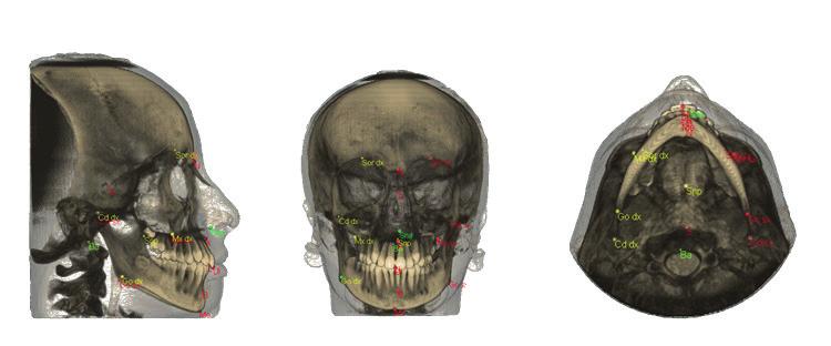 CAPITOLO 1 La diagnosi radiologica in ortognatodonzia Il progetto SEDENTEXCT realizzato da EURATOM European Commission, Radiation Protection 172, Cone Beam CT for Dental and Maxillofacial Radiology,