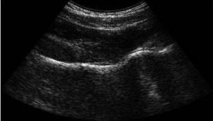 Durante la scansione, l algoritmo riconosce in modo automatico le interfacce ossee (linee rosse in figura) e calcola le ROI per l analisi dei dati (aree verdi in figura).