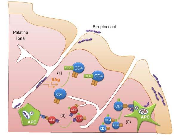 Ipotesi autoimmune Cross-reattività dei linfociti T CD4+ e CD8+ contro la proteina M streptococcica e cheratine umane (KRT14, KRT16, KRT17).