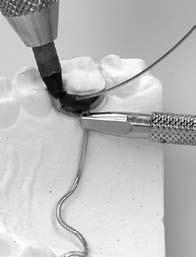 Inserire nelle boccole di fissaggio degli elettrodi a mano rispettivamente l elettrodo a pinza REF 081-701-00 per trattenere l oggetto da saldare e l elettrodo a carboncino REF 081-601- 00 (vedi