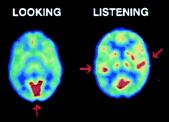 Cerebrale in vivo