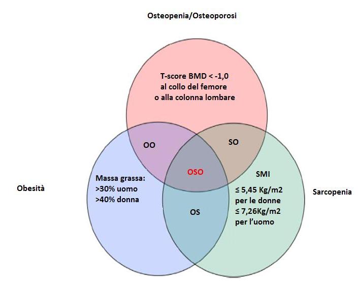 OSO: criteri diagnostici - massa magra appendicolare (ALM) si parla di sarcopenia se l ALM<19,5 Kg nell uomo e ALM<15,02 Kg