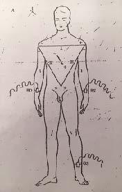 5. i vertici del triangolo vengono considerati a distanza infinita tra loro, per eliminare le differenze interpersonali. Il modello pensato da Einthoven prende il nome di triangolo di Einthoven.