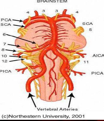 Sindrome dell'arteria basilare (la sindrome dell'arteria vertebrale solitaria è equivalente) Le branche paramediane irrorano il ponte Le circonferenziali brevi irrorano ponte e peduncoli cerebellari