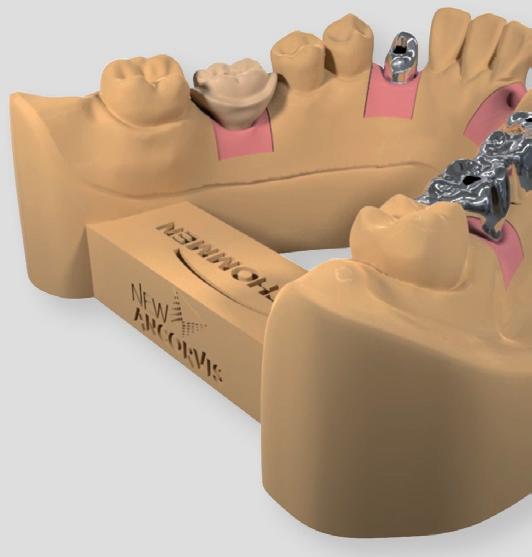 CAD DELLA PROTESI presso New Ancorvis Modellazione digitale ex-novo Centro