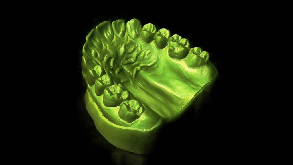 SKYN Concept - Digital Dentistry Se hai mai avuto problemi con il tuo laboratorio di riferimento o se hai tu stesso un laboratorio e vuoi migliorare il tuo rapporto con gli odontoiatri con cui