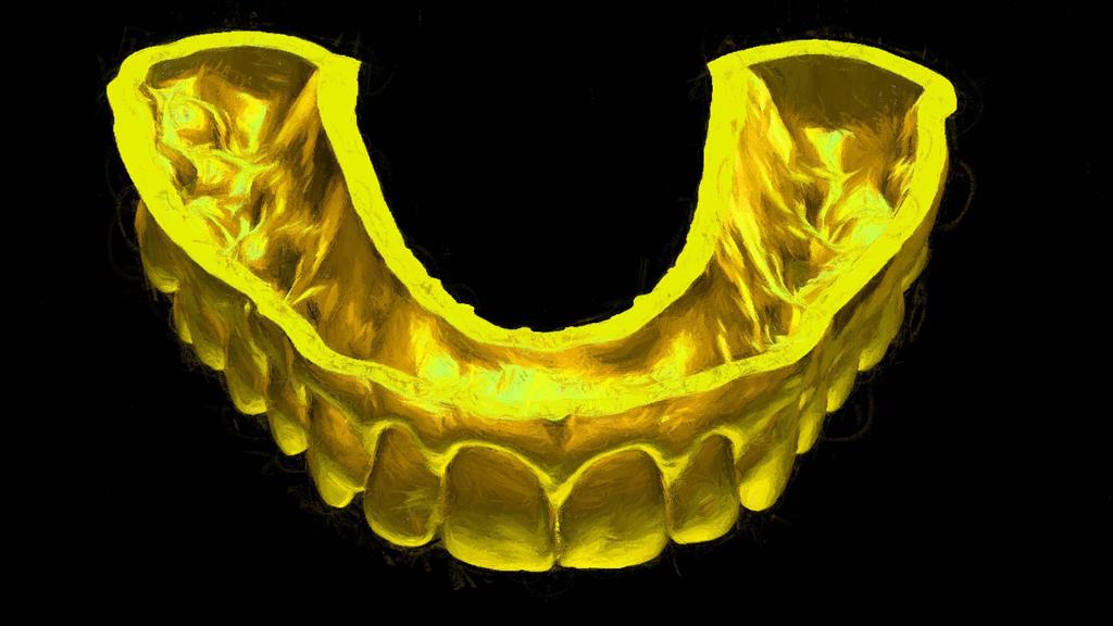 SKYN Concept - Digital Dentistry Crediamo che tu possa imparare solo attraverso 3 passaggi: 1) Conoscere la teoria dietro al concetto, 2) Vederci mentre eseguiamo un caso Live e 3) eseguendo tu