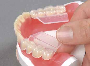 Si ottiene così per la prima volta un montaggio semplice dei denti posteriori con un'eccellente funzione sempre