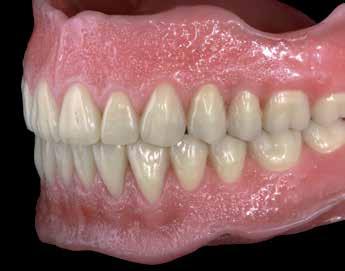 sicurezza d'utilizzo Realizzazione efficace nel laboratorio odontotecnico Qualità costante delle protesi realizzate SEMPLICE Nessuna attrezzatura complessa EFFICACE Fila di denti senza cera =