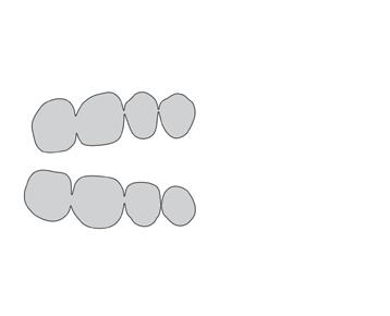 Posterior Q 3 Pack S32 Consigli per denti anteriori sup. / inf.